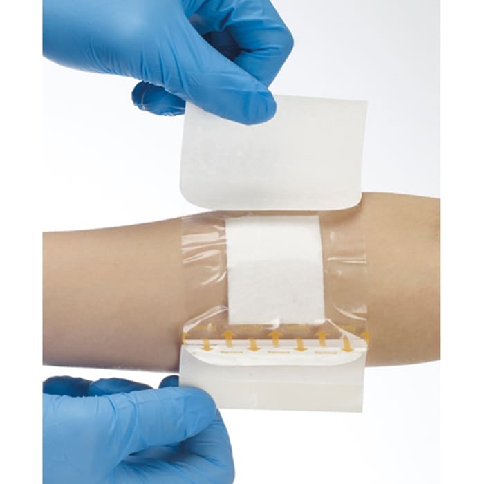 365 Transparent Island Dressings (50) application.